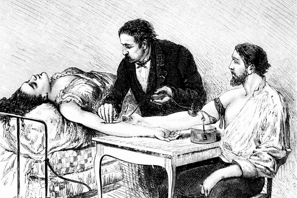 Russian Initiatives in the Study and Practical Application of Blood Transfusion in the XIX century